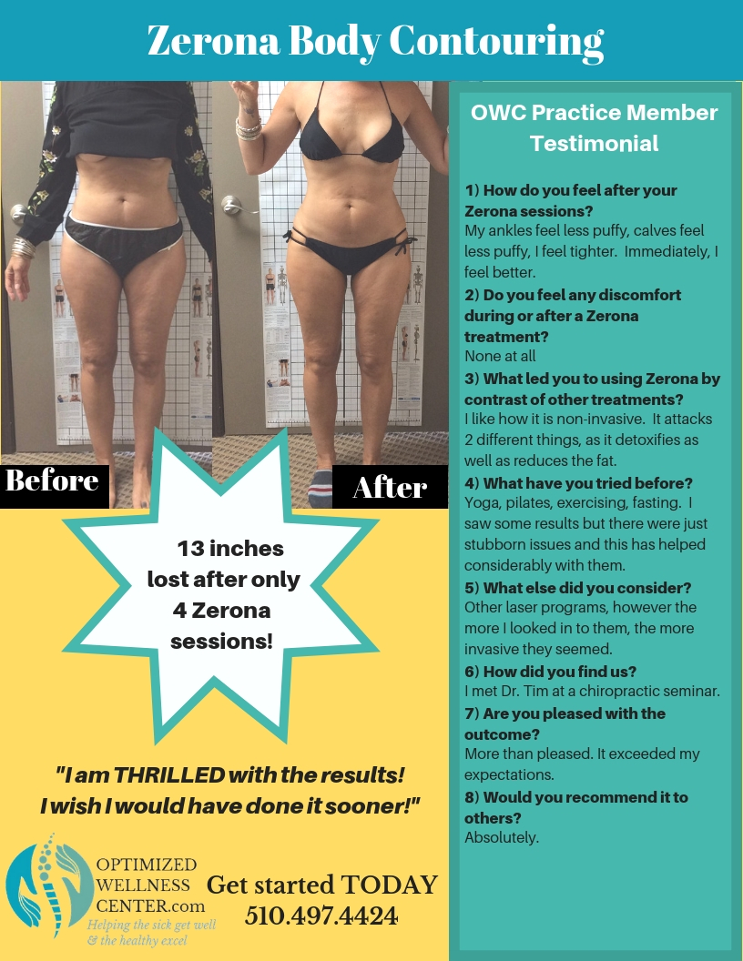 Body Contouring Protocol Overview in Oakland, CA Optimized Wellness